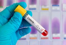 Ojo al dato: ¿Qué es la listeria y por qué puede ser tan peligrosa? ¿Qué es la listeria y por qué puede ser tan peligrosa?
