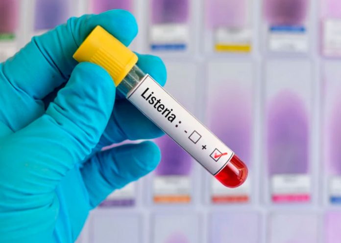 ¿Qué es la listeria y por qué puede ser tan peligrosa?
