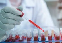 Conocé el significado de los tipos de sangre en cada persona Conocé el significado de los tipos de sangre en cada persona