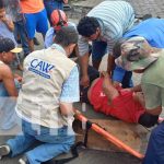 Vendedor de carros se accidenta y termina con fractura expuesta en Managua Fuerte accidente de tránsito en Managua