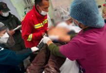 Le desfiguró la cara a machetazo a su hijo en un ataque de ira en Bolivia Le desfigura la cara a machetazo a su hijo en un ataque de ira en Bolivia