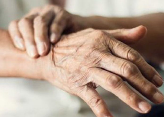 Nuevo método para detectar el «parkinson» analizando la risa de los pacientes