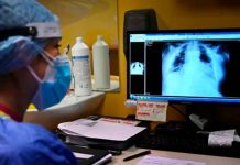 La tuberculosis vuelve a propagarse, advierte la OMS