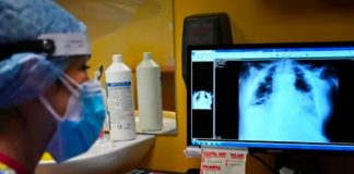 La tuberculosis vuelve a propagarse, advierte la OMS