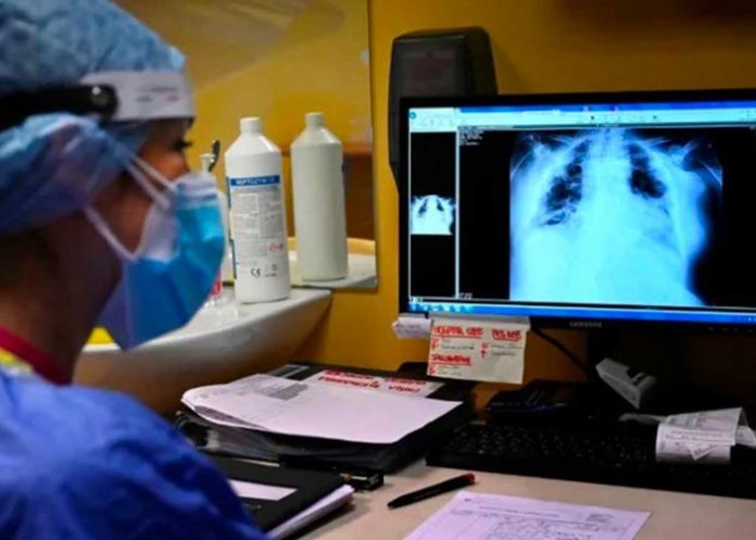 ruber1 La tuberculosis vuelve a propagarse, advierte la OMS