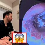 ¿Cómo llegó ahí? Extraen una pieza de arete del oído de una mujer (Video) ¿Cómo llegó ahí? Extraen una pieza de arete del oído de una mujer (Video)