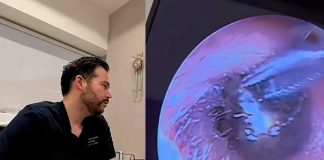 ¿Cómo llegó ahí? Extraen una pieza de arete del oído de una mujer (Video)