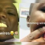 ¡Locura total! Jóvenes de África se cosen la boca para bajar de peso