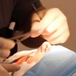 Obligó a su hija de 9 años a realizarse una cirugía plástica y es criticada