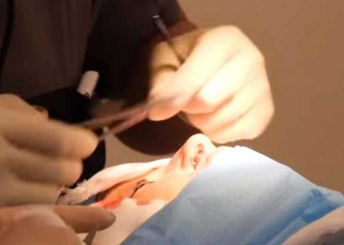 Obligó a su hija de 9 años a realizarse una cirugía plástica y es criticada