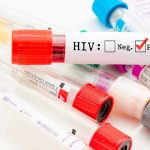 La cura del VIH cada vez más cerca mediante terapia génica La cura del VIH cada vez más cerca mediante terapia génica