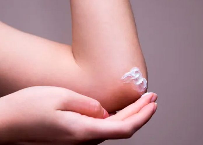 ¿Ya conocías estos tips para aclarar la piel de los codos y rodillas?