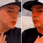 Eduin Caz preocupa a sus fanáticos por una bola en el cuello