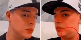 Eduin Caz preocupa a sus fanáticos por una bola en el cuello