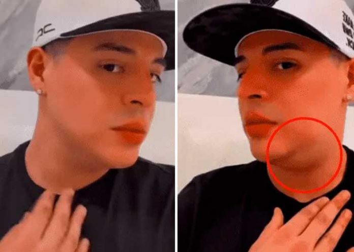 Eduin Caz preocupa a sus fanáticos por una bola en el cuello