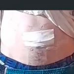 ¡Clase onda!, chavalo se hace viral al quitarse el ombligo