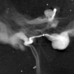 Científicos realizan hallazgo de más hilos cósmicos extraños fuera de nuestra galaxia Científicos realizan hallazgo de más hilos cósmicos extraños fuera de nuestra galaxia