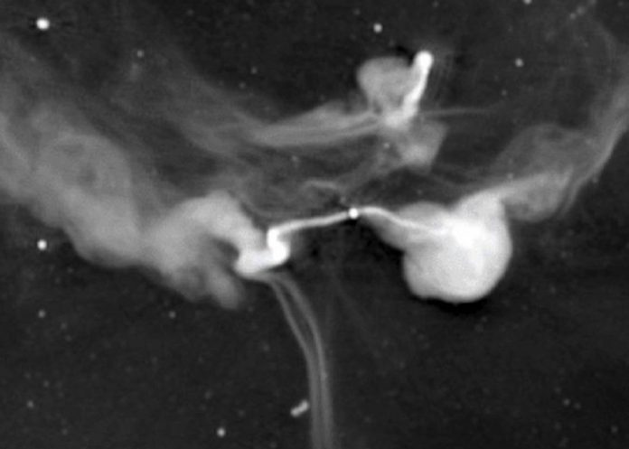 3 Científicos realizan hallazgo de más hilos cósmicos extraños fuera de nuestra galaxia