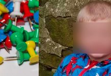 Niño de 5 «muere al tragarse una tachuela» después de su cumple en Reino Unido Bebé se tragó una tachuela y murió tras infartos en Reino Unido