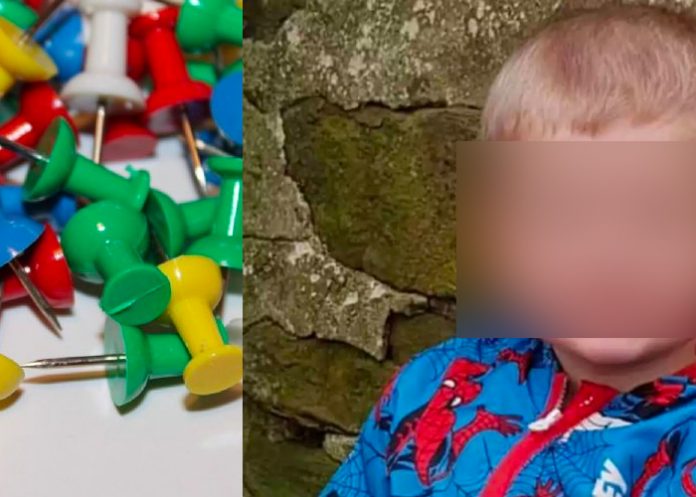 Bebé se tragó una tachuela y murió tras infartos en Reino Unido