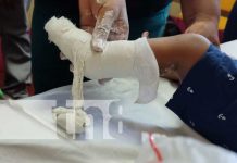 Atención a pacientes con pie equino varo en Bilwi, Caribe Norte Pacientes con pie equino varo en el Caribe Norte ya tienen donde atenderse