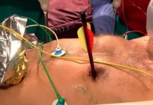 Matan a un hombre de un flechazo en el corazón en Italia por hacer ruido Matan a un hombre de un flechazo en el corazón en Italia por hacer ruido