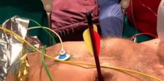 Matan a un hombre de un flechazo en el corazón en Italia por hacer ruido