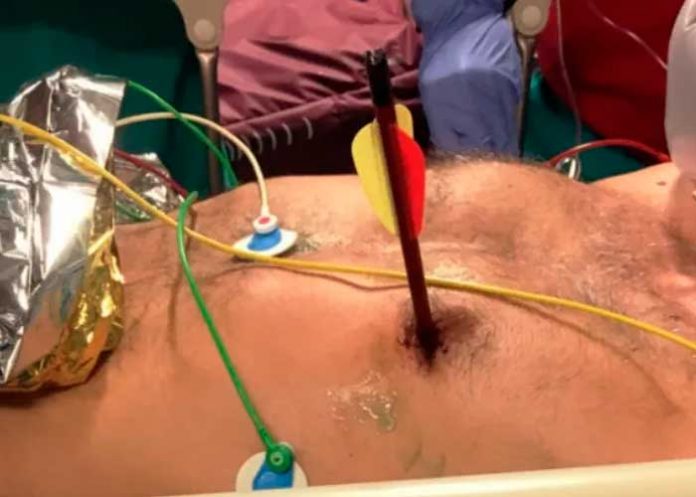 Matan a un hombre de un flechazo en el corazón en Italia por hacer ruido