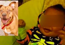 Bebé es atacado por pitbulls en Washington