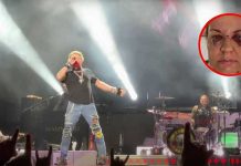 Fanática muestra su rostro luego que Axl Rose la golpeara