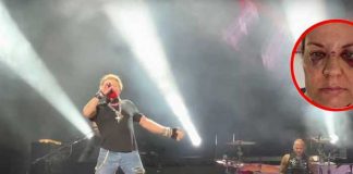 Fanática muestra su rostro luego que Axl Rose la golpeara