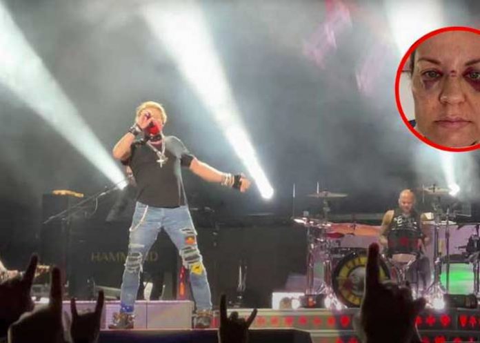 Fanática muestra su rostro luego que Axl Rose la golpeara