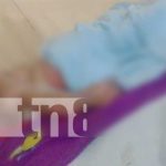 En Jalapa menor de edad resulta con quemaduras en su cuerpo Foto: Menor de edad resulta con quemaduras en su cuerpo en Jalapa/TN8