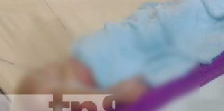 Foto: Menor de edad resulta con quemaduras en su cuerpo en Jalapa/TN8