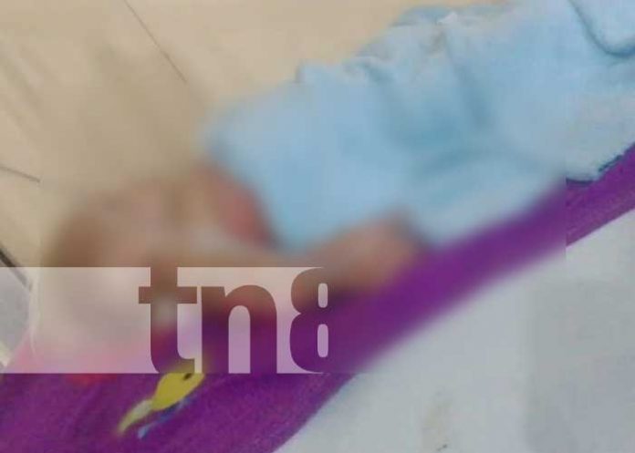 Foto: Menor de edad resulta con quemaduras en su cuerpo en Jalapa/TN8