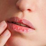 Labios resecos: ¿Por qué pasa y qué hacer? Labios resecos: ¿Por qué pasa y qué hacer?