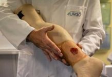 Crean piel artificial para cicatrizar las quemaduras graves Crean piel artificial para cicatrizar las quemaduras graves