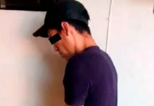 Le arrancó la nariz de un solo mordisco en defensa de su mami en Paraguay Le arrancó la nariz de un solo mordisco en defensa de su mami en Paraguay