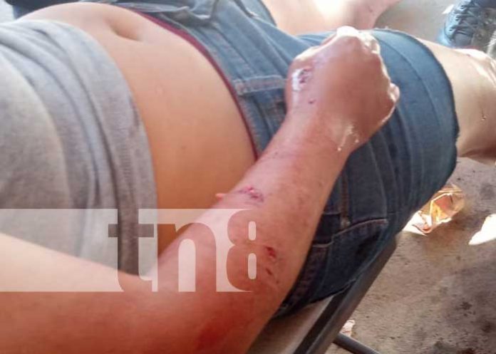 pit-1 Foto: Furioso ataque de un perro Pitbull en San Marcos / TN8