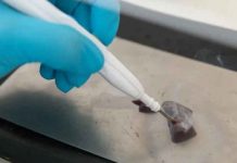 ¡Impresionante! Crean un bisturí, capaz de «oler» tumores ¡Impresionante! Crean un bisturí, capaz de "oler" tumores