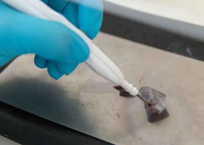 ¡Impresionante! Crean un bisturí, capaz de 