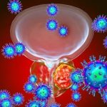 5 indicios de que padeces cáncer de próstata 5 indicios de que padeces cáncer de próstata