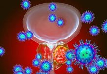5 indicios de que padeces cáncer de próstata