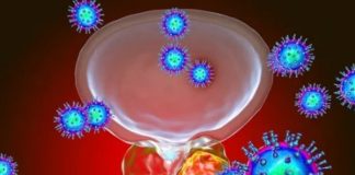 5 indicios de que padeces cáncer de próstata