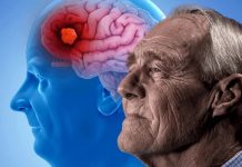 Nuevo tratamiento para el Alzheimer es autorizado por EE.UU. EE.UU. autoriza nuevo tratamiento para la enfermedad de Alzheimer
