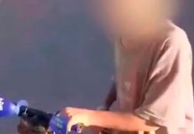 Desgraciado padre en Argentina quema a su hijo para que le consiga dinero