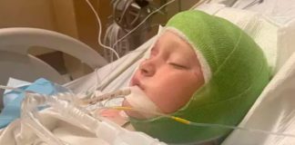 Entre la vida y la muerte deja una manada de perros a un niño en Georgia