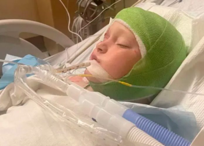 Entre la vida y la muerte deja una manada de perros a un niño en Georgia