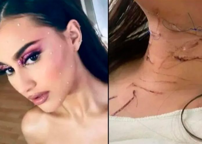 Por ser menor de edad quedó libre tras apuñalar 47 veces a su novia en México