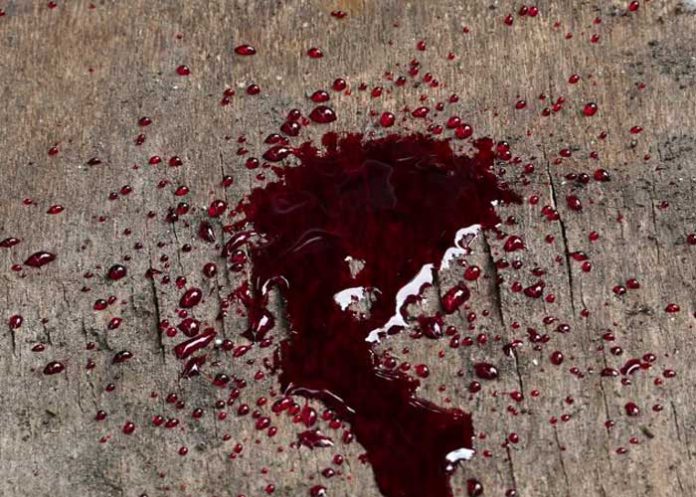 Foto: Charco de sangre / GETTY
